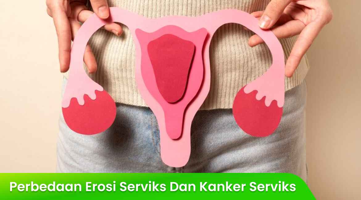 Perbedaan Erosi Serviks dan Kanker Serviks