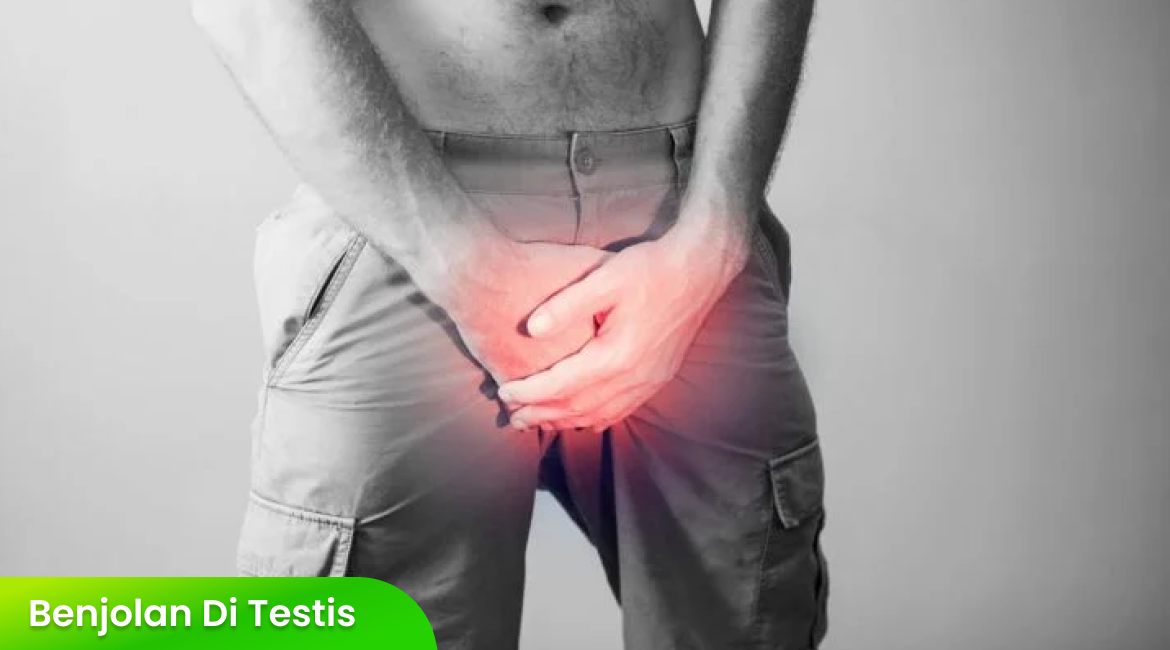 Apakah Benjolan di Testis Berbahaya? Simak Penjelasannya Sebelum Terlambat