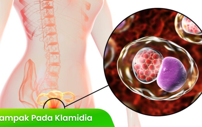 Dampak Klamidia pada Organ Reproduksi