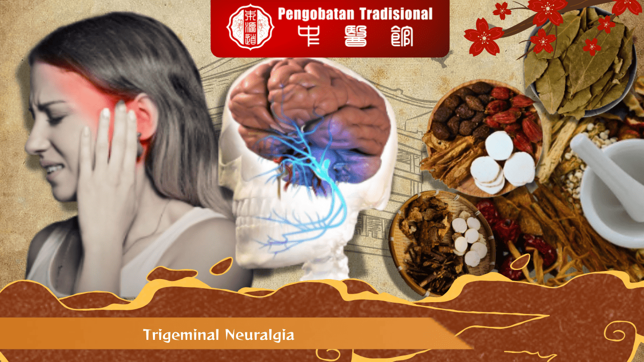 Trigeminal Neuralgia Sakit Tak Tertahankan yang Harus Kamu Ketahui