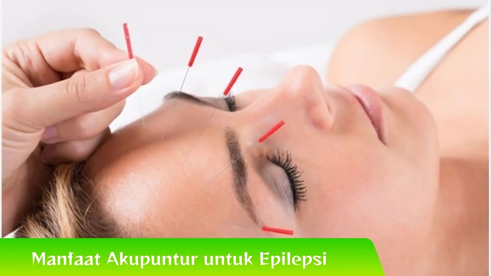 Manfaat Akupuntur untuk Penyakit Epilepsi