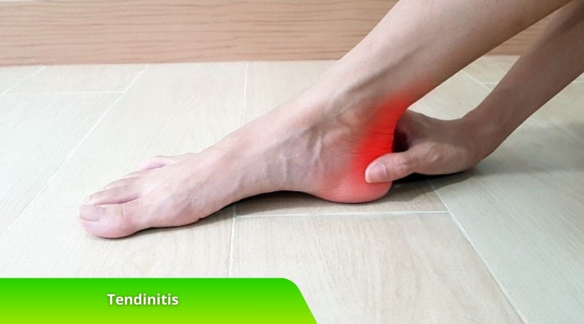 Tendinitis: Penyebab Nyeri Sendi yang Sering Diabaikan