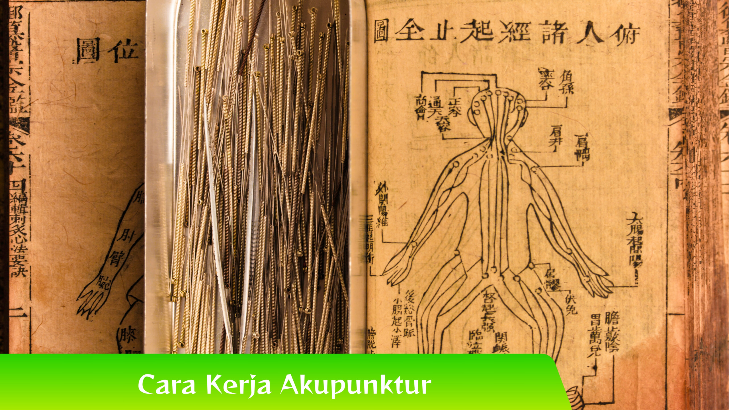 Cara Kerja Akupunktur Mengenal Cara Kerja Akupunktur: Efeknya pada Kesehatan Tubuh