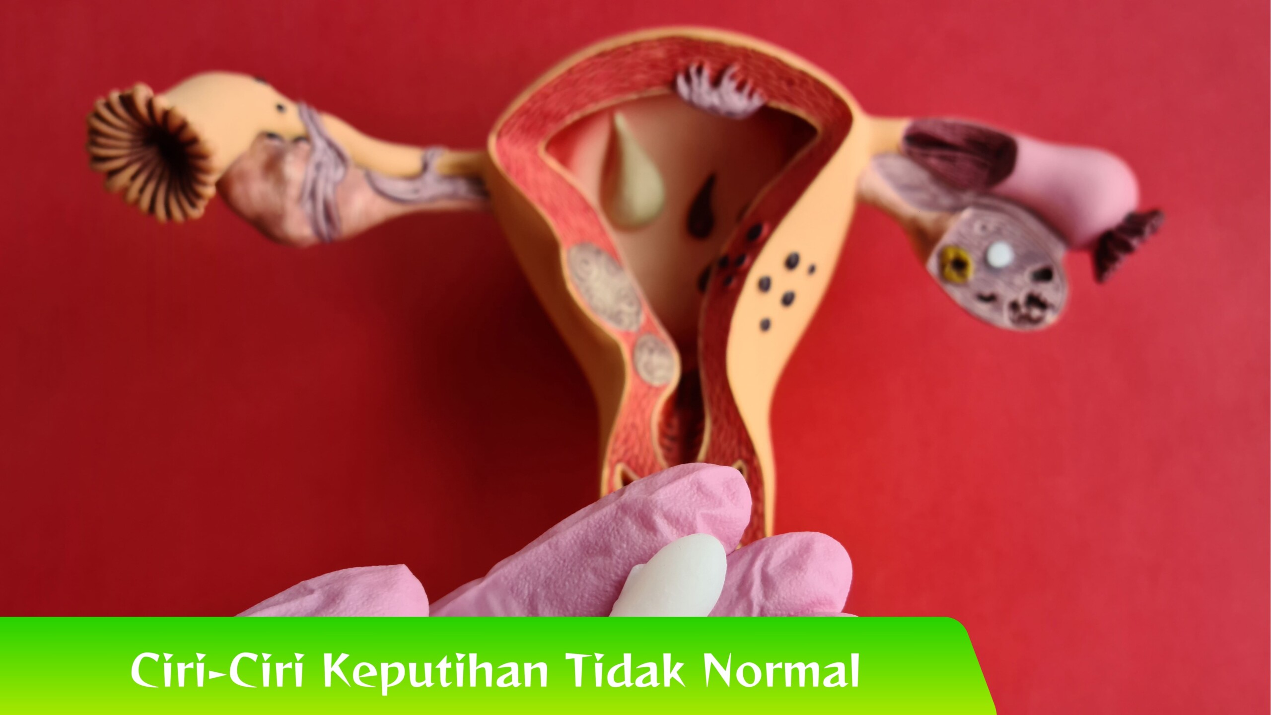 Ciri-Ciri Keputihan Tidak Normal Kenali Ciri-Ciri Keputihan Tidak Normal Sebelum Terlambat