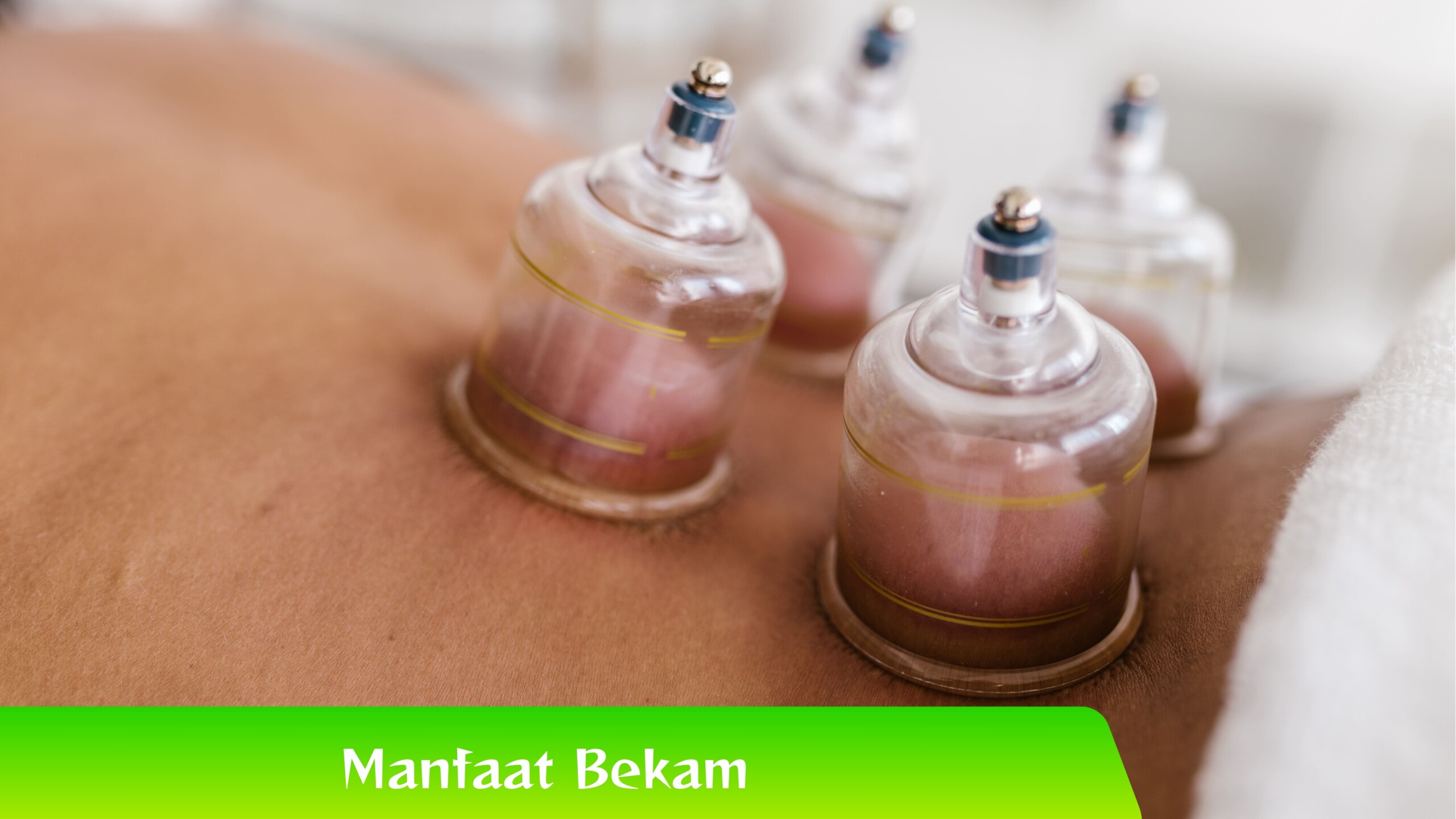 Manfaat Bekam Ini Deretan Manfaat Bekam yang Terbukti oleh Medis