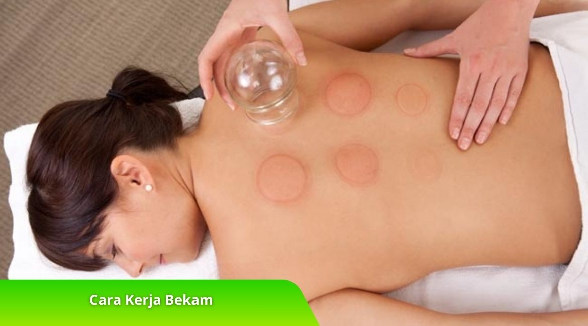 Cara Kerja Bekam untuk Nyeri, Darah Kotor, dan Penyakit Kronis