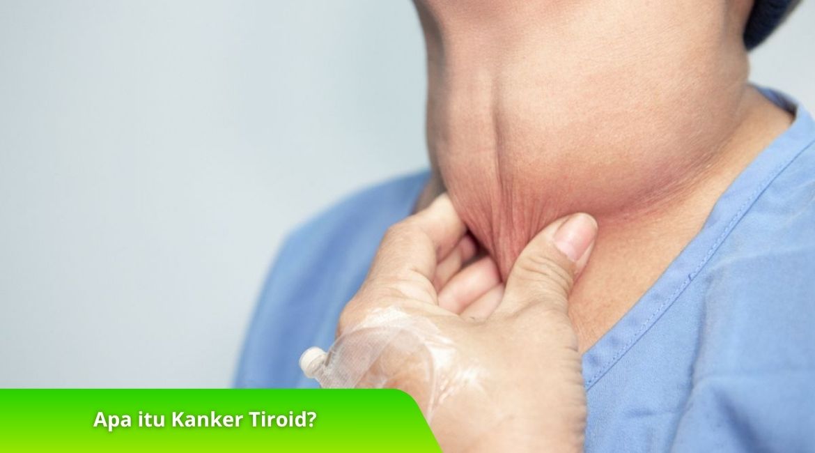 Apa itu Kanker Tiroid Inilah Faktor Risiko dan Pencegahannya Apa itu Kanker Tiroid? Inilah Faktor Risiko dan Pencegahannya