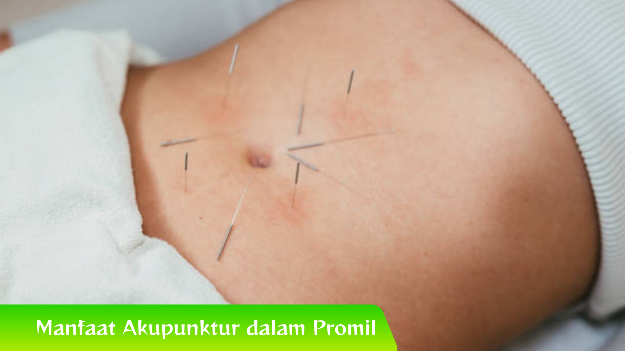 Manfaat Akupunktur dalam Promil Manfaat Akupunktur dalam Promil Menurut Ahli, Kamu Wajib Tahu!