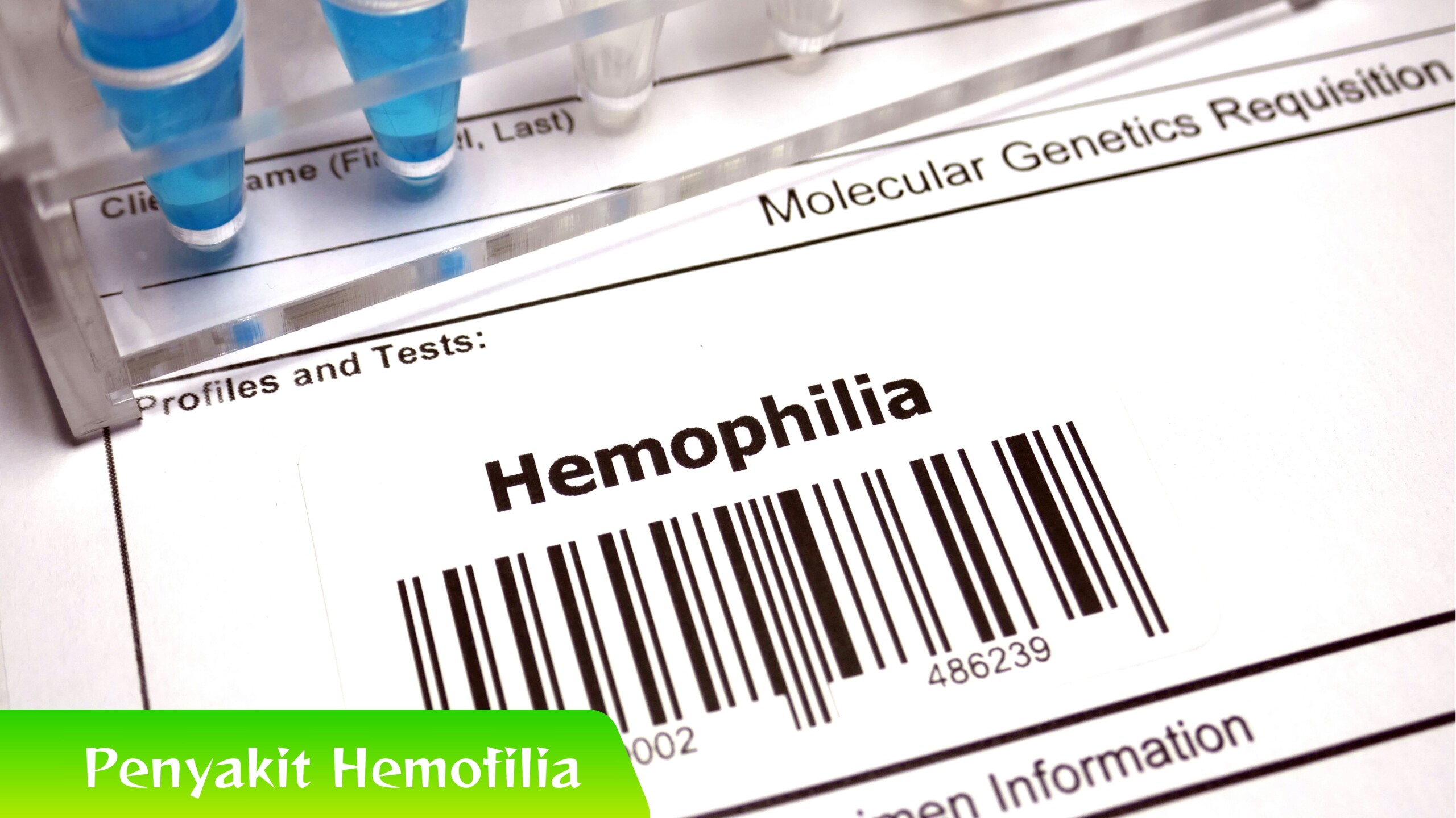 Penyakit Hemofilia Kenali Ciri Awal Penyakit Hemofilia, Yuk Simak!