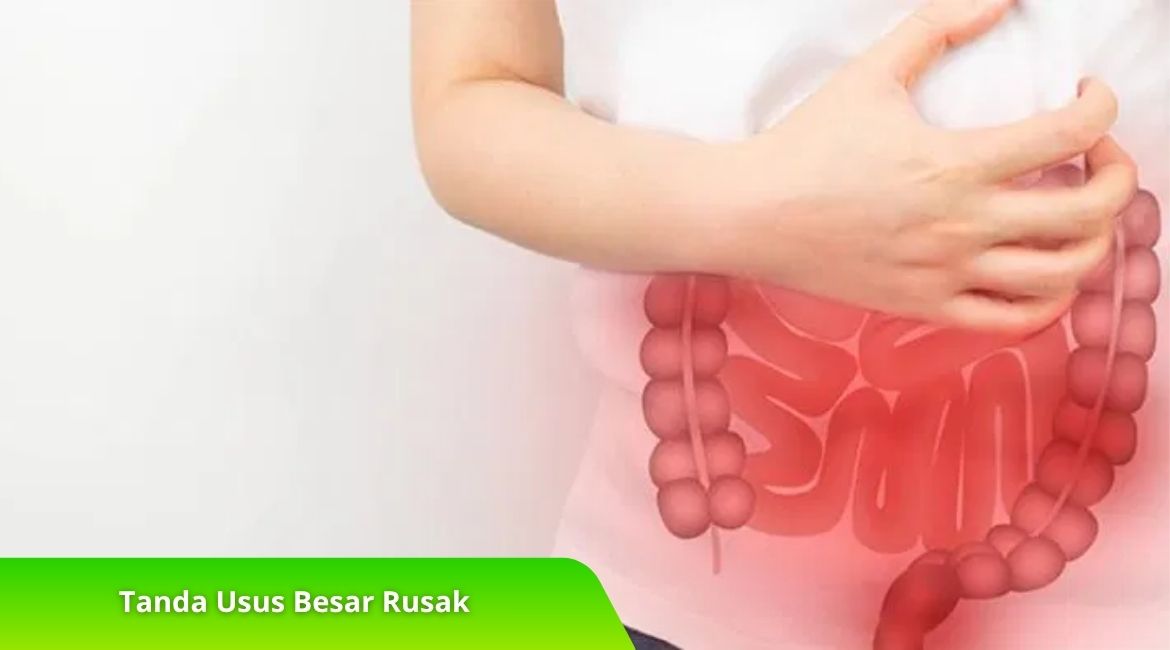 Tanda Usus Besar Rusak dan Cara Memulihkannya Secara Alami Tanda Usus Besar Rusak dan Cara Memulihkannya Secara Alami