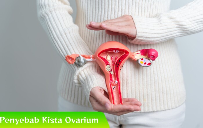 Waspadai 6 Penyebab Kista Ovarium dan Pengobatan Tradisional