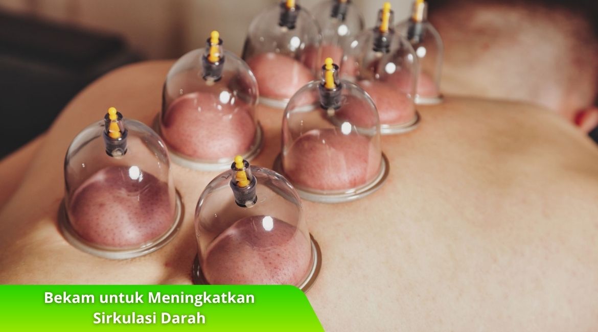 Bekam untuk Meningkatkan Sirkulasi Darah: Manfaat dan Cara Kerjanya