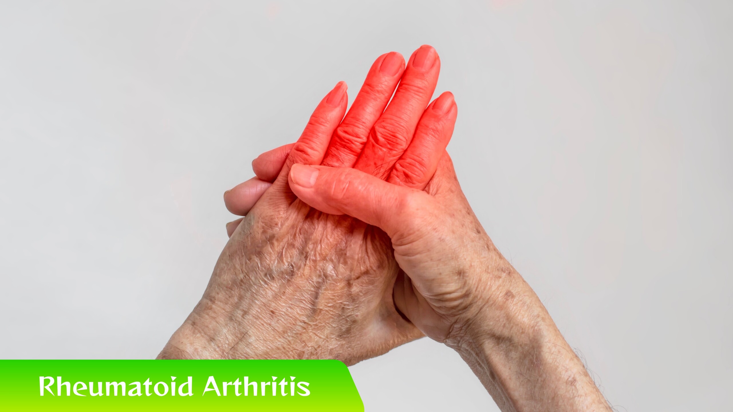 Kok Sendi Sakit Terus? Awas, Rheumatoid Arthritis!